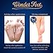 Wonder Foot Exfoliating Foot Mask - with Lactic Acid & Milk (PH3.6) – Guaranteed to Rejuvenate Your foot In 7 Days - Sold Exclusively on Amazon