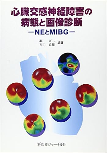心臓交感神経障害の病態と画像診断 Neとmibg 正二 堀 良雄 石田 本 通販 Amazon