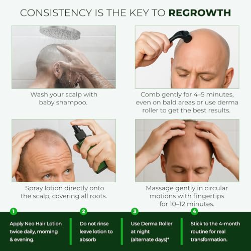 Green Wealth Neo Hair Lotion for Hair Loss Treatment | Hair Regrowth | Thinning, Bald Spots & Hair Fall | Trusted Formula with Ginseng, Saw Palmetto & Horsetail | 120ml