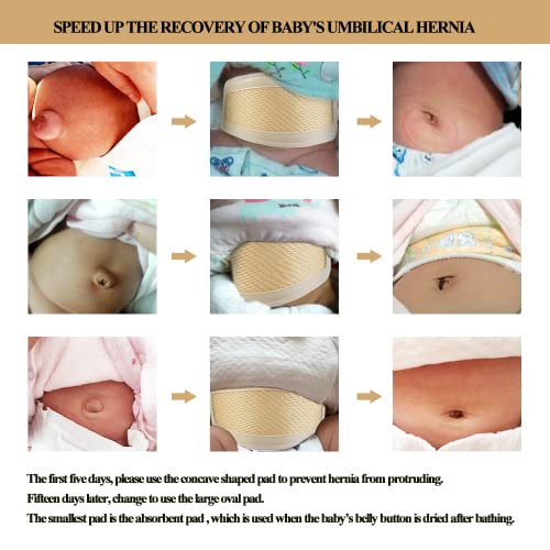 Umbilical Hernia Belt Baby Belly Button Band Infant Belly Wrap Truss