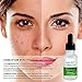 Aroamas, Dark Spot Corrector, Brightening Spotless Oil, lightens skin - For Face and Body - Even Skin tones - Anti-Aging - Jojoba Oil, Olive Oil, Rose Oil, Vitamin E