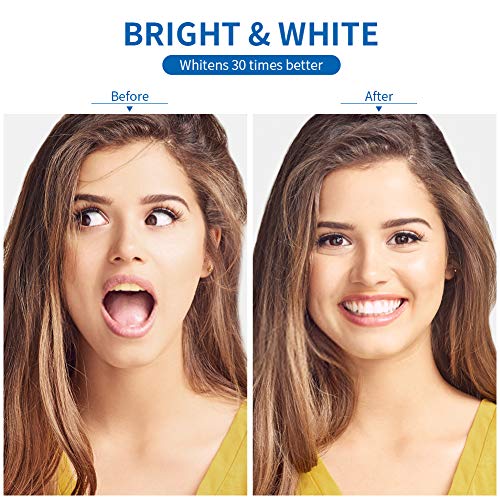 Bestidy Teeth Whitening Pen (2 Pack), Natural Carbamide Peroxide Gel,20+ Uses, Effective, Painless, No Sensitivity, Travel-Friendly, Easy to Use, Beautiful White Smile, Natural Mint Flavor
