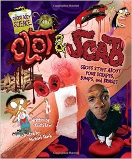 Clot Amp Scab Gross Stuff About Your Scrapes Bumps And Bruises Gross Body Science Kristi Lew