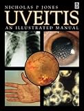 Uveitis : An Illustrated Manual, Jones, Nicholas P., 0750632305