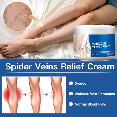 LBOYLOVE® 2 PCS Varicose Veins Cream for Legs, Spider Varicose Veins ReliefCream, SkinCream for Legs, Cream for VaricoseVeins