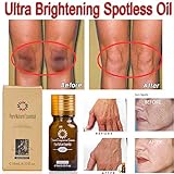 Ultra Brightening Spotless Oil Dark Spots Removal Age Spots Hyper-Pigmentation(2PCS)