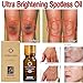 Ultra Brightening Spotless Oil Dark Spots Removal Age Spots Hyper-Pigmentation(2PCS)