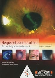 Herpès et zona oculaire