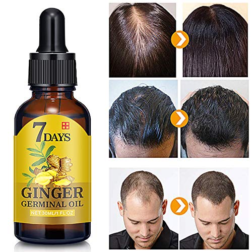 Hair Growth Oil Serum Liquid Hair Loss Treatment for Men Women Thicken Healthier Stronger Longer Hair，Stimulate Hair Follicles to Stop Hair Loss and Regrow Hair, All Hair Type