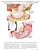 Netter's Illustrated Human Pathology Updated Edition: with Student Consult Access (Netter Basic Science)