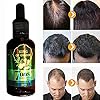 Hair Growth Serum, Hair Care Product, Hair Serum, Fast Hair Growth, Hair Growth & Hair Thickening,Stop Hair Loss, Grow…