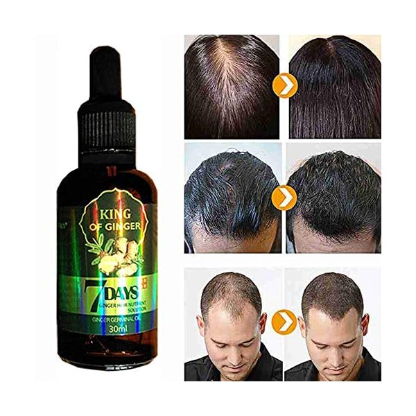 Hair Growth Serum, Hair Care Product, Hair Serum, Fast Hair Growth, Hair Growth & Hair Thickening,Stop Hair Loss, Grow…