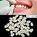 IVORIE Ultra Thin Whitening Veneers Resin Teeth Upper Anterior 50PCS (A2)