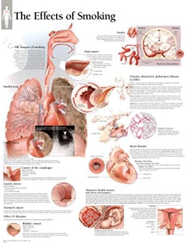 Effects of Smoking Educational Chart Poster 22 x 28in with Poster Hanger