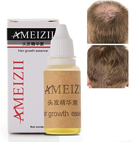Hair Growth Essence Oil Serum Strengthens Hair Roots Grow Longer Anti Hair Loss & Hair Thinning Treatment Hair Serum (20ml)