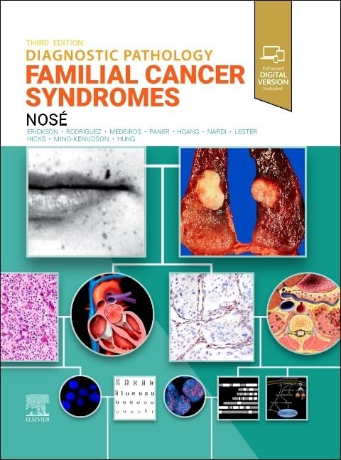 Diagnostic Pathology: Gastrointestinal: 9780443287336: Medicine