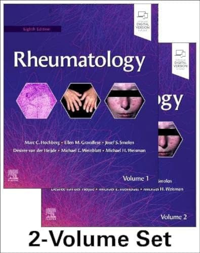Glaucoma: 2-Volume Set: 9780702051937: Medicine & Health Science
