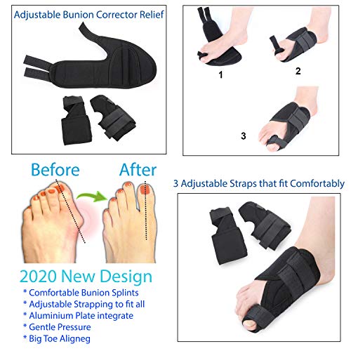 Bunion Corrector and Hallux Valgus Pain Relief Kit Orthopedic Big Toe Straightener