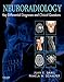 Neuroradiology: Key Differential Diagnoses and Clinical Questions