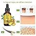 DAGEDA Upgrade Ginger Hair Growth Oil, Hair Growth Treatment for Women Men With Thinning Hair Loss Serum for Healthier, Thicker, Longer Hair, Repairs Hair Follicles, Promotes Hair Regrowth（30ml）thumb 1