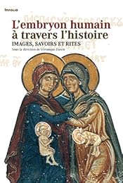 L' embryon humain à travers l'histoire