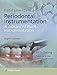 Fundamentals of Periodontal Instrumentation and Advanced Root Instrumentation