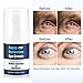 Rapid Reduction Eye Cream-Kinbeau Eye Cream for Under-Eye Bags Treatment,Instant Results within 120 Seconds,Eye Cream for Dark Circles and Puffiness,Wrinkles (5 ml/0.17o)thumb 1