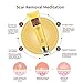 Acne Scar Removal Cream Skin Repair Face Cream For Burns Cuts Operation Stretch Mark Remover Acne Scar Treatment
