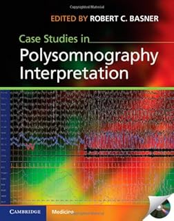 Principles Of Polysomnography Online Pdf