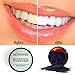 Activated Charcoal Teeth Whitening Powder + 2 Bamboo Toothbrushes | Natural & Organic Coconut - Food Grade, Guaranteed | Alpine Choice