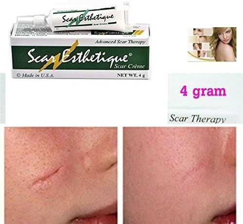 Scar Esthetique Cream Advanced Scar Therapy Treatment Burns Keloid Acne Scar 4g. by Scar Esthetique