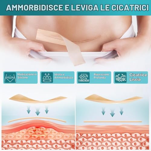 Silicone Scarring Sheets, Silicone Scars Plasters, 4 cm x 300 cm | Custom cut, everyday comfort and easy application