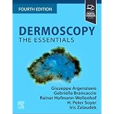 Dermoscopy: The Essentials