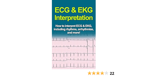 Amazon Com Ecg Ekg Interpretation How To Interpret Ecg Ekg Including Rhythms Arrhythmias And More Ebook Pine Jeremy Kindle Store