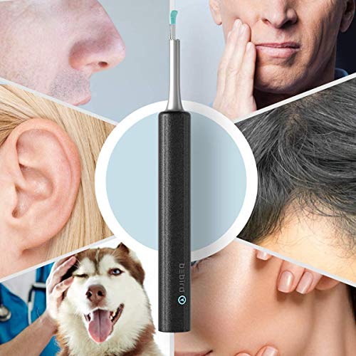 Bebird Ear Wax Removal Otoscope Inspection Camera 1080P FHD Digital