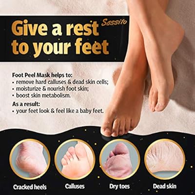 cracked heels baby foot