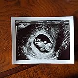 Prank 2D Customized Ultrasound SINGLE PHOTO ONLY