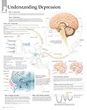 Understanding Depression chart: Laminated Wall Chart