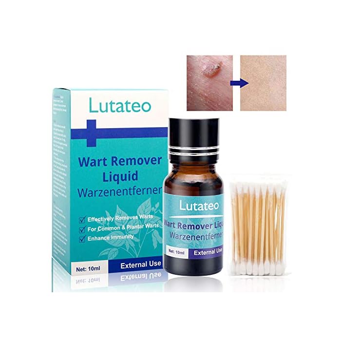 Buy Wart Removal, and Removes Common and Plantar Warts, Wart