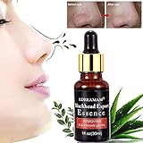 Blackhead Remover,Blackhead Extractor,Anti Blackhead,Face Skin Care Anti-blackhead Essence Shrink Pores Essence,Deep Pore Cleanse for bleakhead Acne,Resist Oily Skin Strawberry Nose