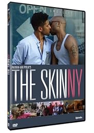 The Skinny