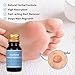 Avashine Wart Removal, Painlessly Removes Common, Hand and Plantar Wart Remover, Maximum Strength Wart Liquid, Strong & Effective Wart Infection Treatmentthumb 2