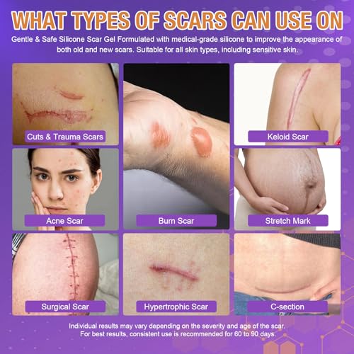 Advanced Scar Gel – Silicone Scar Gel for Keloid Bump Removal, Post-Surgery Scars, Acne Scars, Burn Marks & Stretch Marks – Scar Treatment for Old & New Scars – 1.2oz / 35g
