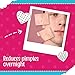Bye Bye Blemish Acne Drying Lotion, On-the-Spot Pimple Treatment, Reduce Pimples Overnight, Beauty Skincare Essential - 1oz. (2-Pack)