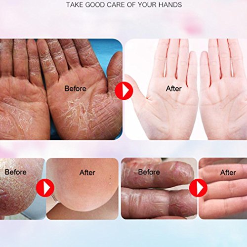 DZT1968 1pc/140g Antifreeze Crack Skin Care Cream Moisturizing Body Crack skin chapped Protection - Thumbnail 2