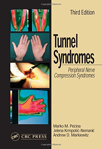 Tunnel Syndromes