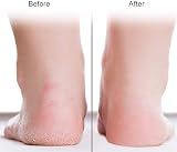 HURRISE Silicone Gel Moisturizing Socks for Women Foot Care Crack Prevention view 6