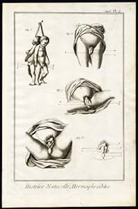 Amazon.com: Antique Print-HERMAPHRODITE-SEXUALITY-SEX ORGAN-VAGINA
