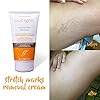 Cicatrissim Stretch Marks Removal Cream - Innovative Natural Formula With Pure and Potent Ingredients From Brazilian…