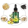 Ginger-Germinal-Oil-3-PACK2020-Hair-Growth-TreatmentHair-SerumAnti-Hair-Loss-Thinning-Balding-Repairs-Hair-Follicles-Promotes-Thicker-Stronger-Hair-And-Promotes-Hair-Regrowth Ginger Germinal Oil 3 PACK,2020 Hair Growth Treatment,Hair Serum,Anti Hair Loss, Thinning, Balding, Repairs Hair…